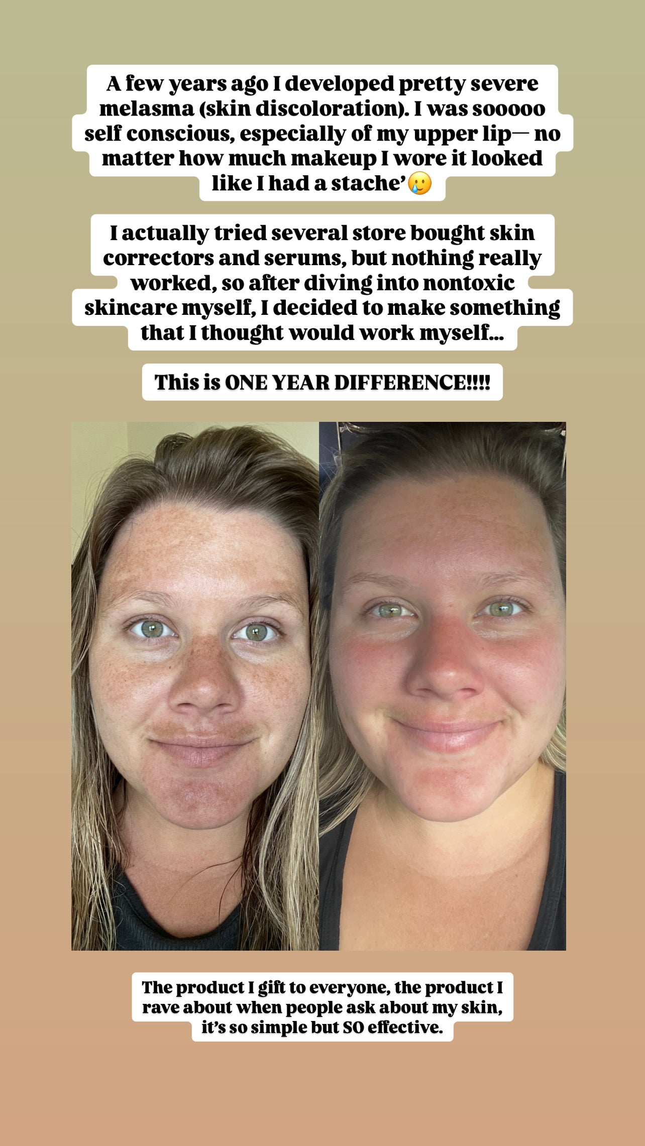 Nature's Skin Enhancer - Skin Serum